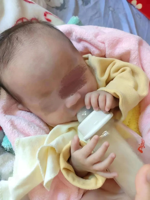 海南省人民医院成功救治省内最小胎龄早产儿