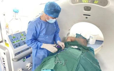 海医二院肿瘤内科团队为原发性小肝癌患者实施微波消融技术