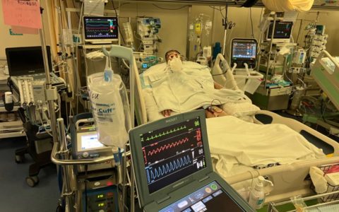 海南医学院第二附属医院急诊科VA-ECMO成功救治心梗后严重心源性休克一例