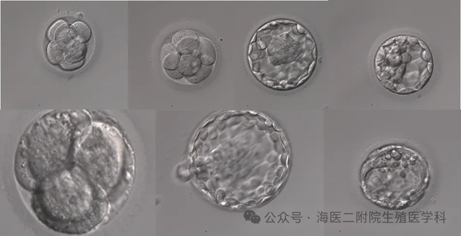 生育力保存——为肿瘤患者存下希望的种子