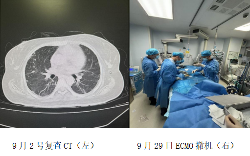 女孩心脏骤停命悬一线，海医一附院重症医学科用ECMO续写生命奇迹