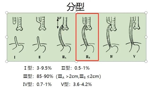 出生仅47天经历2次手术！海南省人民医院多学科联合巧手为食管闭锁宝宝打通“生命通道”